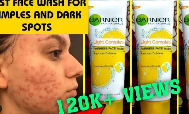 garnier face wash woman pimples