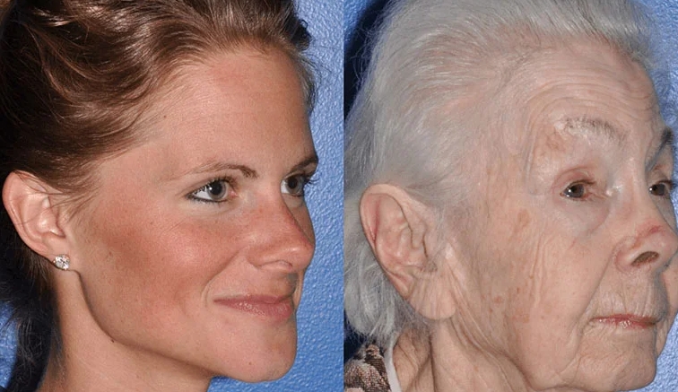 how a womanʼs face ages